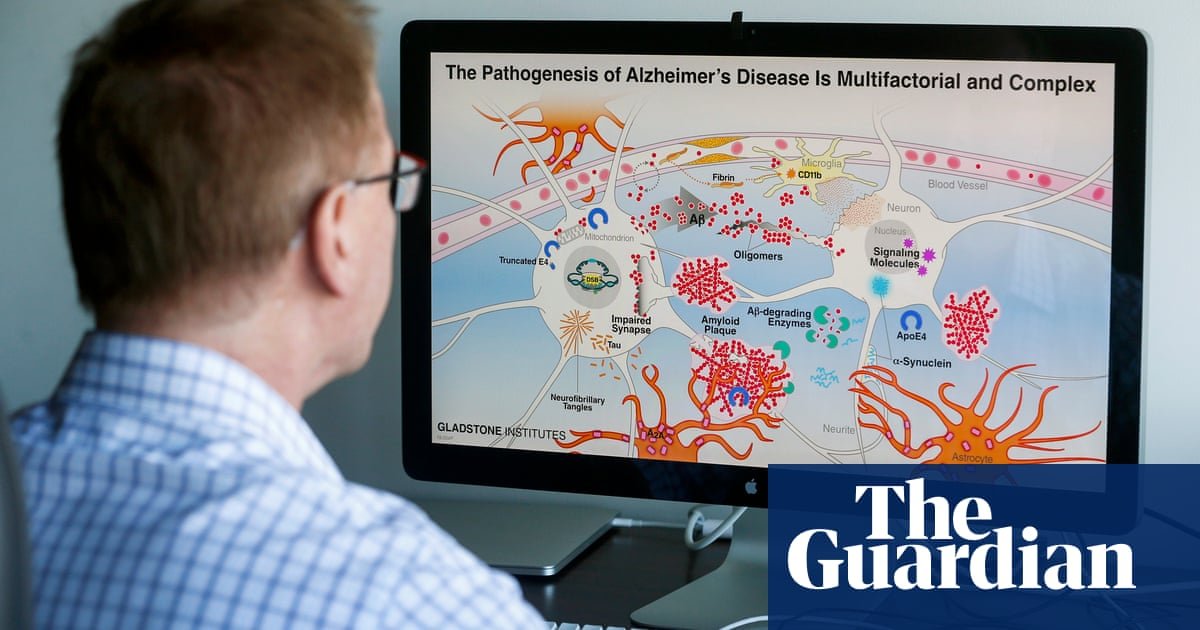 Os centros de pesquisa de Alzheimer enfrentam o atraso de financiamento de US $ 65 milhões em Trump nos EUA | Administração Trump